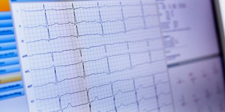 EKG-Verlauf erscheint auf dem Bildschirm